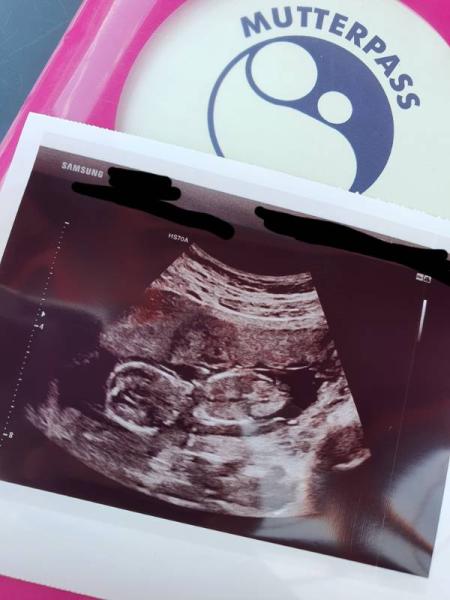 Bild zu Termin mit Nackenfaltenmessung - Forum für Dezember - Mamis