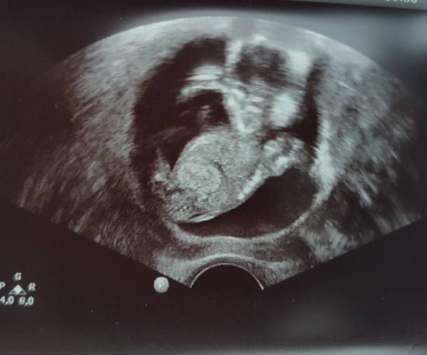 Bild zu 3. Ultraschall - Forum für Dezember - Mamis
