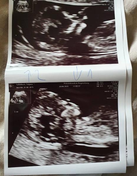 Bild zu Auch wir sind im 2 Trimester seit heute - Forum für Dezember - Mamis