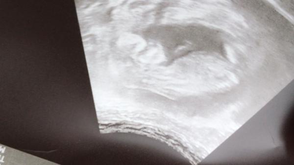 Bild zu Was denkt ihr? - Forum für Dezember - Mamis