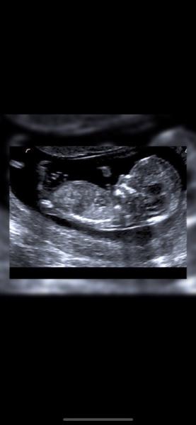 Bild zu Erkennt jemand das Geschlecht 🧐 - Forum für Dezember - Mamis