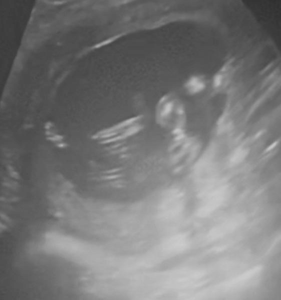 Bild zu Geschlecht? - Forum für Dezember - Mamis