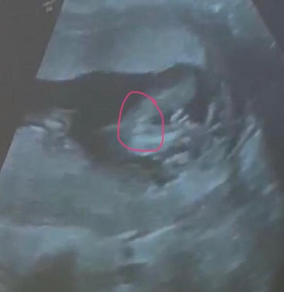Bild zu Geschlecht? - Forum für Dezember - Mamis