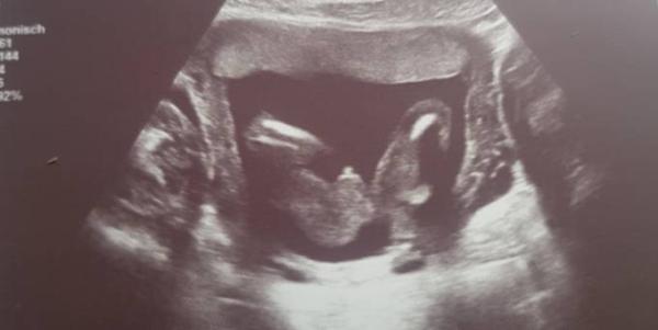 Bild zu Outing 💙💖 - Forum für Dezember - Mamis