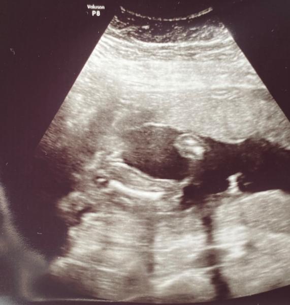 Bild zu Ist es wirklich ein Mädchen? - Forum für Dezember - Mamis