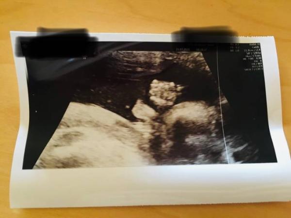 Bild zu Organscreening - Forum für Dezember - Mamis