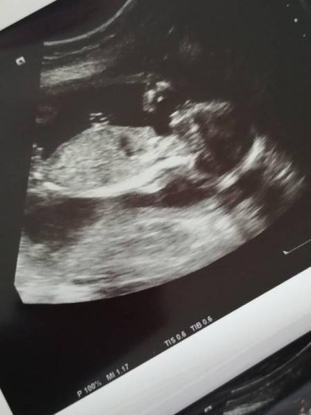 Bild zu Auch 2. Ultraschall und Outing - Forum für Dezember - Mamis
