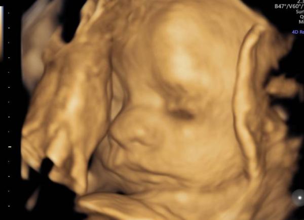 Bild zu Zurück vom Ultraschall - Forum für Dezember - Mamis