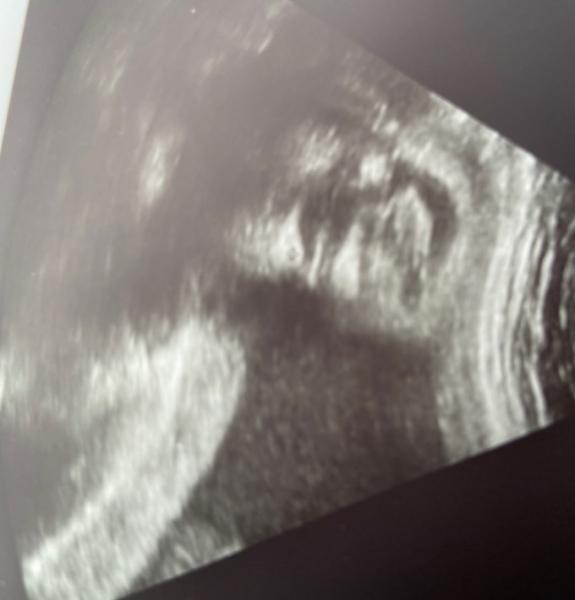 Bild zu Soll ich es glauben? - Forum für Dezember - Mamis