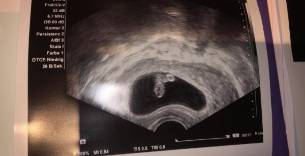 Bild zu Regenbogenbaby - Forum für Dezember - Mamis