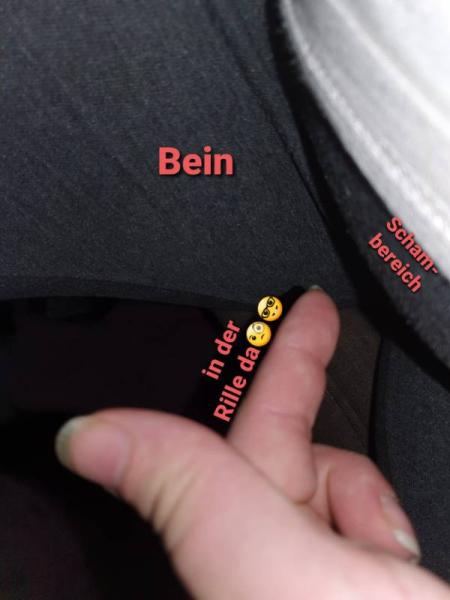 Bild zu Ein kleines intimes Problem - unten Wund... - Forum für Dezember - Mamis