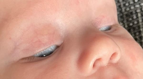 Bild zu Baby verdreht Augen nach unten - Forum für Dezember - Mamis