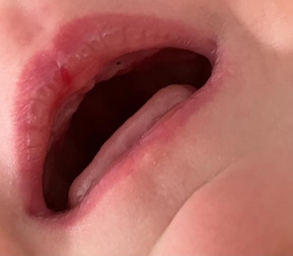 Bild zu Schwarzer Punkt am Zahnfleisch - Forum für Dezember - Mamis