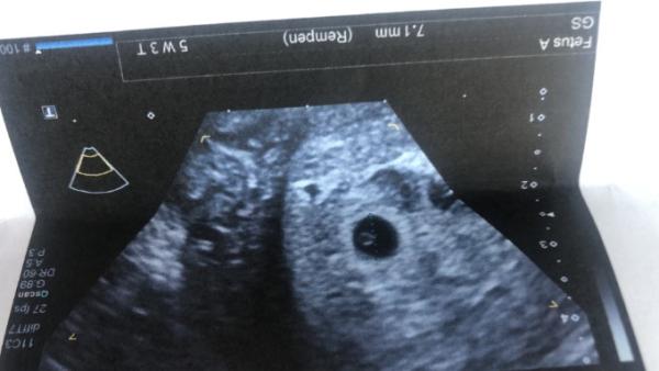 Bild zu Überglücklich😍 - Forum für Dezember - Mamis