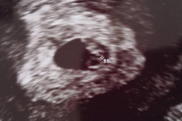 Bild zu Update: Herz schlägt - Forum für Dezember - Mamis