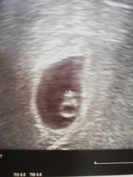 Bild zu Darf ich vorstellen: - Forum für Dezember - Mamis