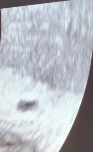 Bild zu Fruchthöhle in SSW 6 - Forum für Dezember - Mamis