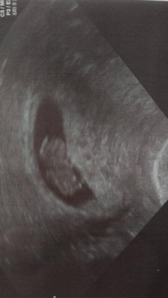 Bild zu Schockverliebt đ - Forum fĂŒr Dezember - Mamis