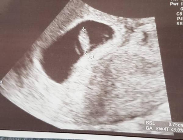 Bild zu Geschafft - Forum für Dezember - Mamis
