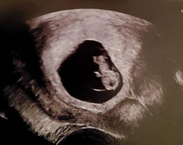 Bild zu 1. Ultraschall - Forum für Dezember - Mamis