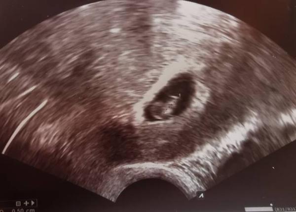 Bild zu Dann mach ich es mal auf meinem Platz bequem! - Forum für Dezember - Mamis