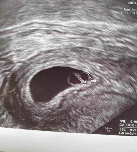Bild zu Zurück von FA :( - Forum für Dezember - Mamis