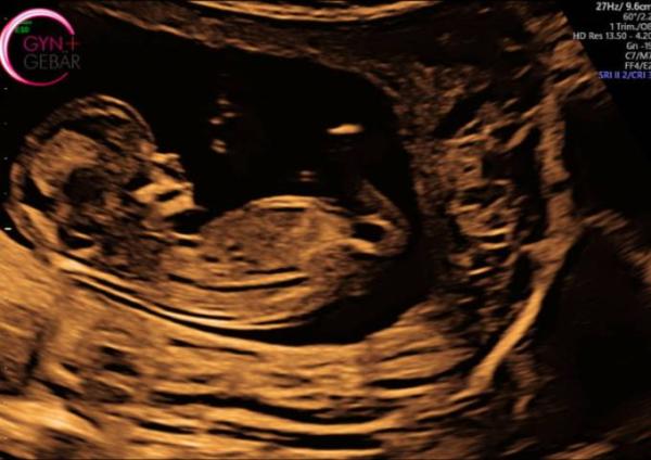 Bild zu Zurück vom Combined Test ❤️ - Forum für Dezember - Mamis
