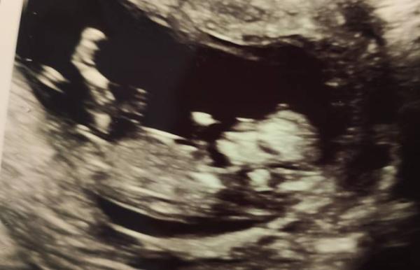Bild zu Zurück vom Arzt - Forum für Dezember - Mamis