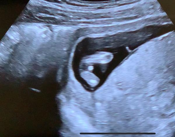 Bild zu Welches Geschlecht - Forum für Dezember - Mamis