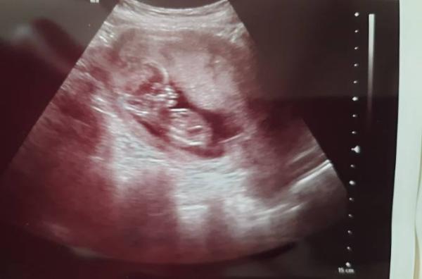 Bild zu Quirliges Baby - Forum für Dezember - Mamis