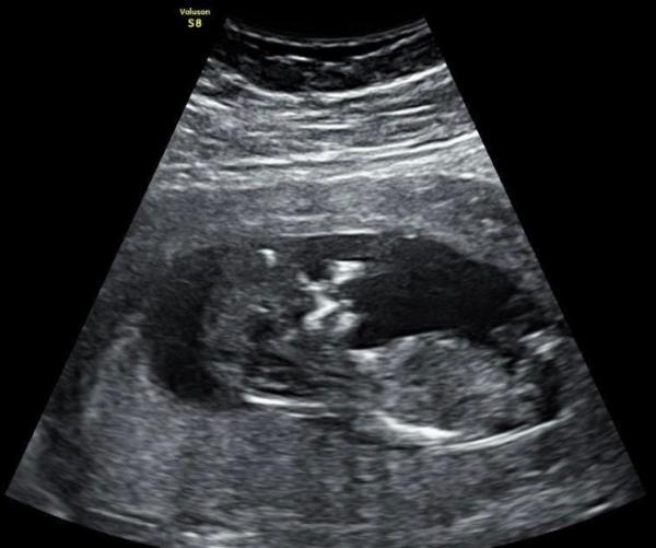 Bild zu NUB-Methode - Forum für Dezember - Mamis