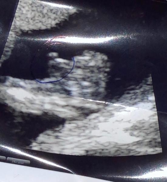 Bild zu Outing und Kindsbewegungen - Forum für Dezember - Mamis
