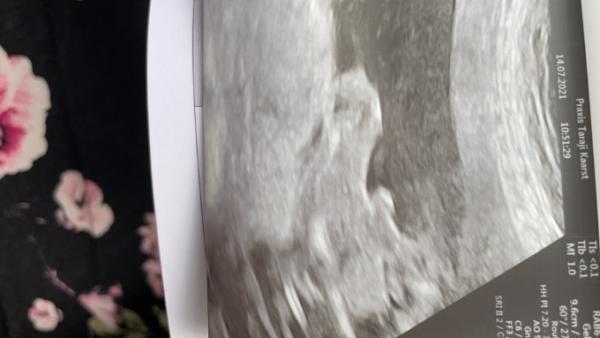 Bild zu Geschlecht - Forum für Dezember - Mamis