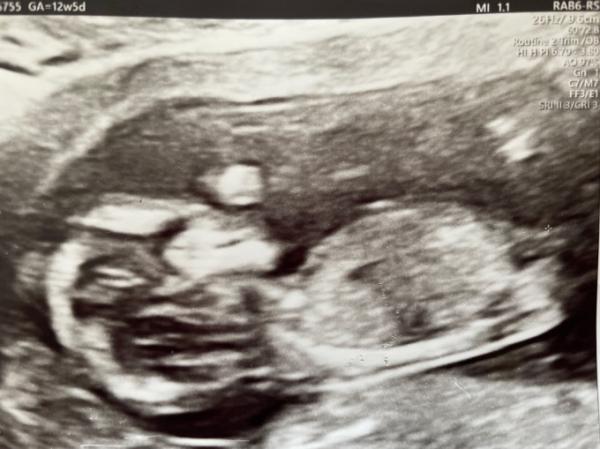 Bild zu Nub Theorie - Forum für Dezember - Mamis