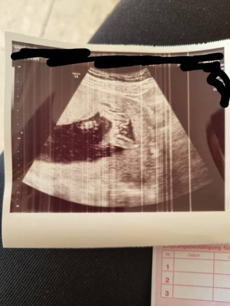 Bild zu Kann das Bild nicht entziffern! Sieht man hier schon das Geschlecht? - Forum für Dezember - Mamis