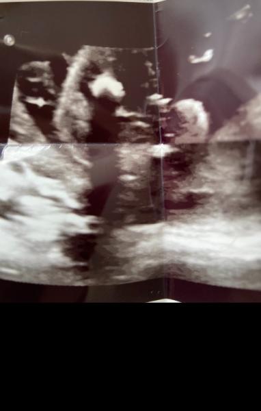 Bild zu Wirklich Mädchen? - Forum für Dezember - Mamis