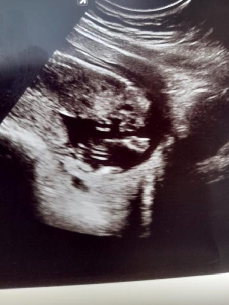 Bild zu Geschlecht? - Forum für Dezember - Mamis