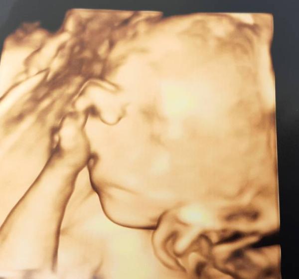 Bild zu Gewicht Baby - Forum für Dezember - Mamis