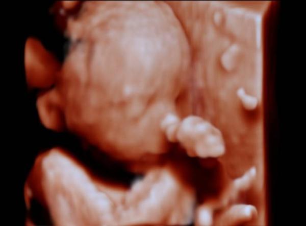 Bild zu Organscreening 22. Ssw - Forum für Dezember - Mamis