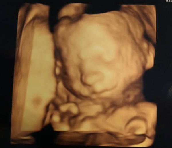 Bild zu Grosser Ultraschall - Forum für Dezember - Mamis