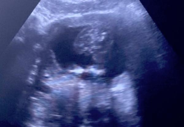 Bild zu Die Ärztin möchte sich auf kein Geschlecht festlegen - Forum für Dezember - Mamis