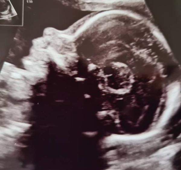 Bild zu Organscreening - Forum für Dezember - Mamis