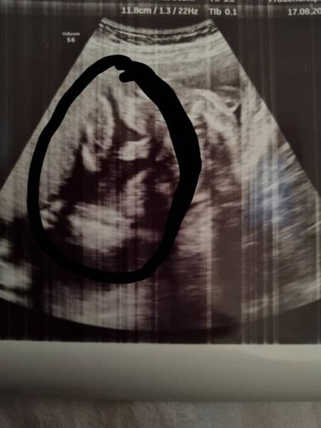 Bild zu Junge, oder? 😍🥳💙 - Forum für Dezember - Mamis
