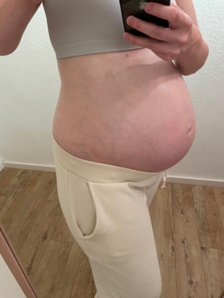 Bild zu Adern Durchblutung Bauch/Brüste - Forum für Dezember - Mamis
