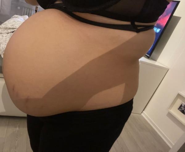 Bild zu Senkwehen oder doch schon richtige? - Forum für Dezember - Mamis