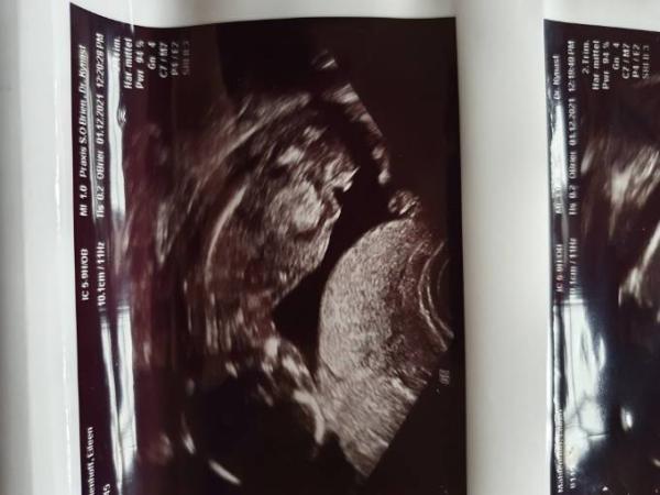 Bild zu Geschlecht Outing 15 ssw sicher? - Forum für Dezember - Mamis
