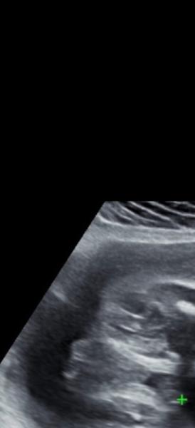 Bild zu Hier noch mal ein bild zur frage - Forum für Dezember - Mamis
