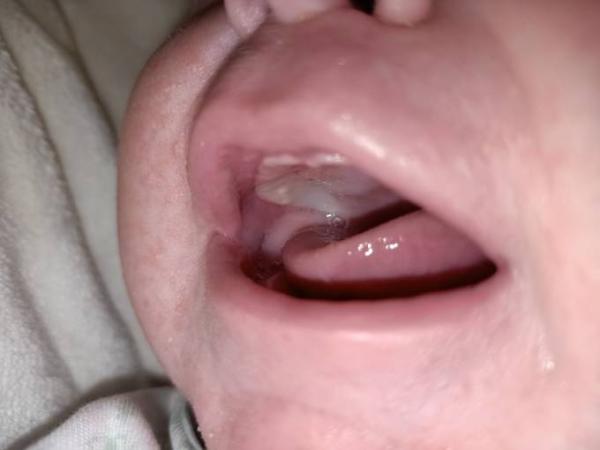Bild zu Zahnen? - Forum für Dezember - Mamis