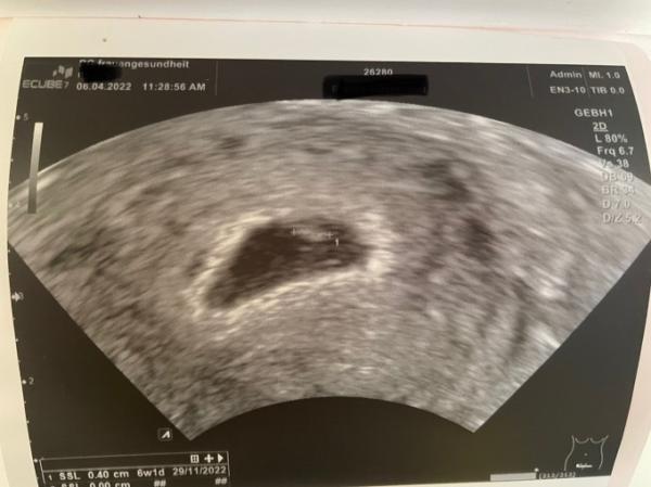 Bild zu Wir haben einen Herzschlag đź’• - Forum fĂĽr Dezember - Mamis