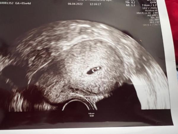 Bild zu Erstes US Bild 5+4 - Forum für Dezember - Mamis